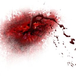 Arterial bleeding_1.png